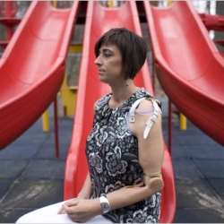 NYtimes article on Bionic Arm Woman. Creepy video of her psychic arm control too. 