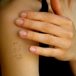 As a twist on the subdermal tattoos ~ implants that create braille messages... The Braille Tattoo, designed by Klara Jirkova 