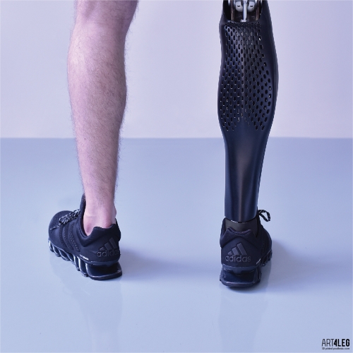 Tomas Vacek designed the prosthetic leg cover for ART4LEG.