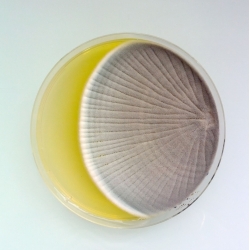 Antoine Bridier-Nahmias's blog , Magical Contamination captures the beauty of bacterial contamination.