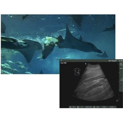 A look inside the 'womb' of a manta ray! Scientists ultrasound the manta to glimpse the babies inside.