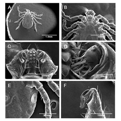 Live ticks become the first animals to be observed under a scanning electron microscope while alive.