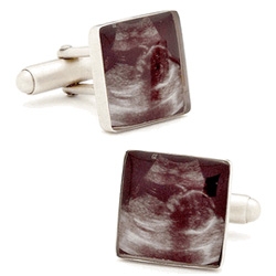Sonogram Cufflinks ~ could this be the creepiest way to break the news to a unsuspecting dad to be?