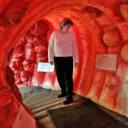 An inflatable, 20-foot long, 8-foot high replica of a human colon, teaching people all across America that colorectal cancer is preventable, treatable and beatable!