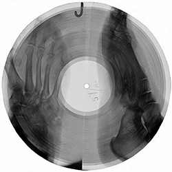 X-ray records - Soviet era homemade records. "They would cut the X-ray into a crude circle with manicure scissors and use a cigarette to burn a hole," says author Anya von Bremzen. 