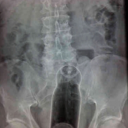 A fascinating Flickr stream from a radiographer working in a hospital A&E department - it includes both extreme trauma breaks and also 'foreign objects'
